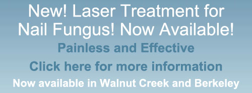 Laser Toenail Treatment